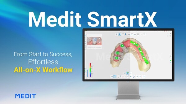 medit launches a new all-on-x solution, medit smartx